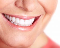 teeth_whitening_1 | Duffield Dentistry | Dentist Royal Oak, MI