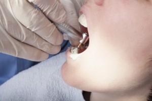 Considering braces or Invisalign? Find out about the pros and cons of each. 
