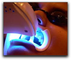 Tooth Whitening Dentistry In Birmingham